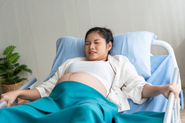 tortikolis pada bayi, bayi kepala miring, gejala tortikolis, cara mengatasi leher kaku bayi, fisioterapi bayi, posisi tidur bayi, tortikolis kongenital